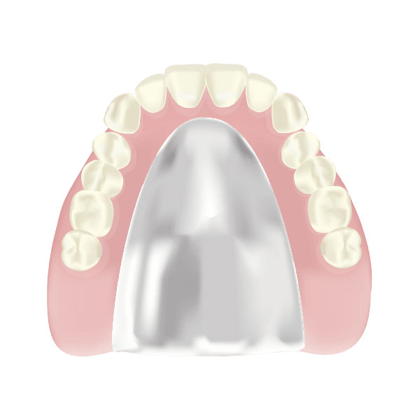 コバルトクロム床義歯