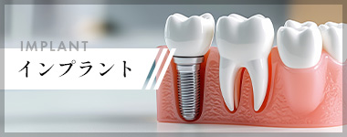 インプラント